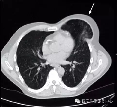 说明: 图片